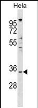 IMPACT Antibody in Western Blot (WB)