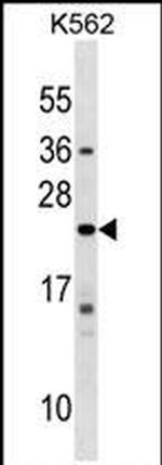 Interferon alpha-10 Antibody in Western Blot (WB)