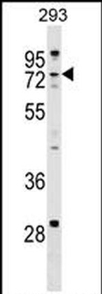 ZCCHC8 Antibody in Western Blot (WB)