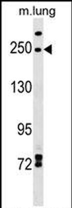 INF2 Antibody in Western Blot (WB)