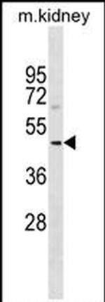 SDS3 Antibody in Western Blot (WB)