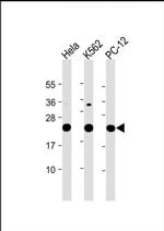 LZIC Antibody in Western Blot (WB)
