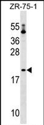 Bit1 Antibody in Western Blot (WB)