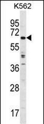 TRIM75P Polyclonal Antibody
