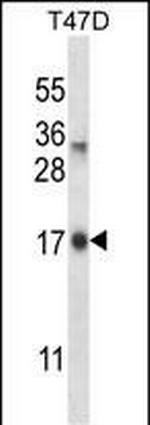IGF2-AS Polyclonal Antibody