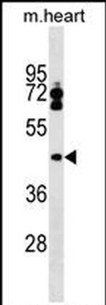 LPXN Antibody in Western Blot (WB)