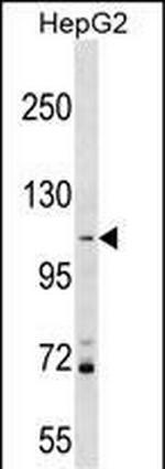 PROSER1 Antibody in Western Blot (WB)