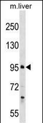 PROSER1 Polyclonal Antibody