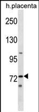 STKLD1 Antibody in Western Blot (WB)