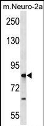 RNF207 Antibody in Western Blot (WB)