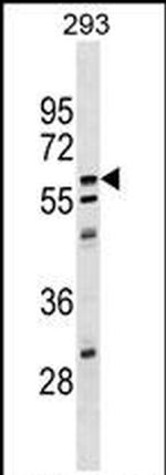 CPNE5 Antibody in Western Blot (WB)