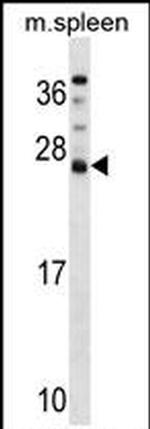 DNAJC5B Antibody in Western Blot (WB)