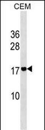 ADM2 Polyclonal Antibody