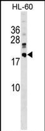DNAJC30 Antibody in Western Blot (WB)