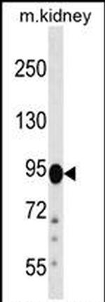 FIG4 Antibody in Western Blot (WB)