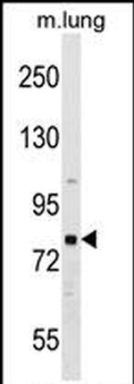RHPN1 Antibody in Western Blot (WB)