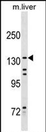 KIF15 Antibody in Western Blot (WB)