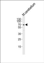 MTF2 Antibody in Western Blot (WB)