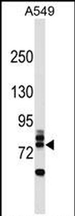 RNF157 Antibody in Western Blot (WB)