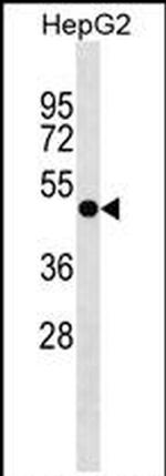 FAPP2 Antibody in Western Blot (WB)