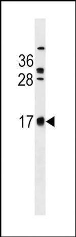 C2orf83 Antibody in Western Blot (WB)