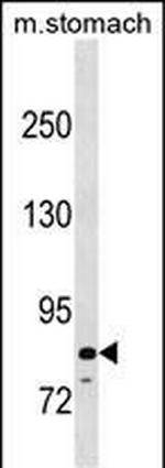 PADI6 Polyclonal Antibody