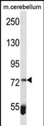 ZBTB39 Antibody in Western Blot (WB)