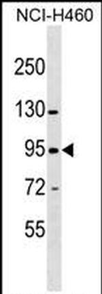 ZNF484 Antibody in Western Blot (WB)