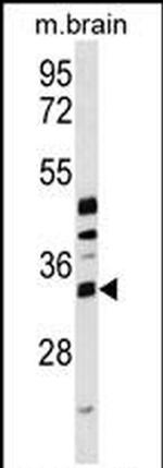 METTL6 Antibody in Western Blot (WB)
