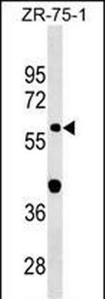 GDPD2 Polyclonal Antibody