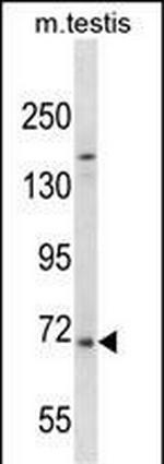 EXTL1 Polyclonal Antibody