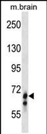 GLB1L Antibody in Western Blot (WB)