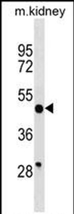 HGH1 Antibody in Western Blot (WB)