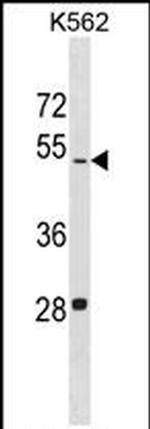 LDHAL6B Antibody in Western Blot (WB)