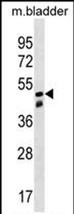 SNX8 Antibody in Western Blot (WB)