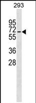 ZWILCH Antibody in Western Blot (WB)