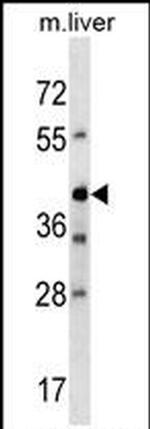 AVPR1B Antibody in Western Blot (WB)