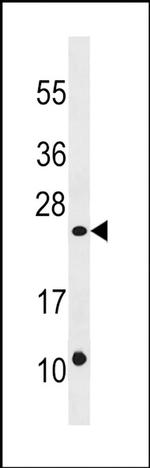 DUSP13 Antibody in Western Blot (WB)