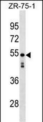 KRT87P Polyclonal Antibody