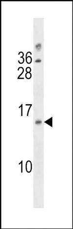 LIMS3 Antibody in Western Blot (WB)