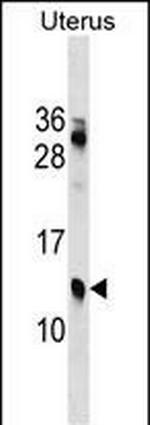 KLKP1 Polyclonal Antibody
