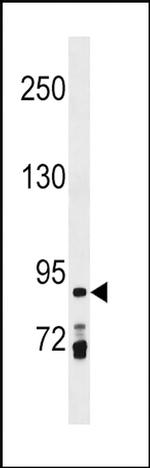 PRICKLE1 Antibody in Western Blot (WB)