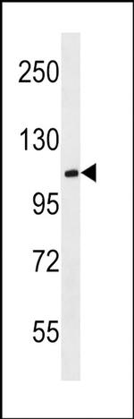 MBD6 Antibody in Western Blot (WB)