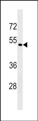 eIF2 gamma Antibody in Western Blot (WB)