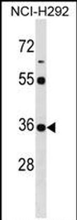 KCTD17 Antibody in Western Blot (WB)