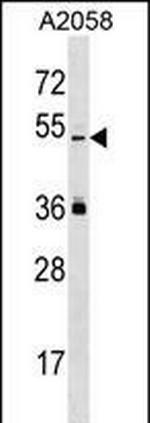 PRAMEL Polyclonal Antibody