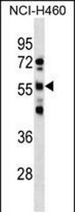 RBMY1D Polyclonal Antibody