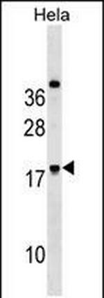 RNF224 Antibody in Western Blot (WB)