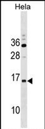 RPP14 Antibody in Western Blot (WB)