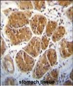AGO2 Polyclonal Antibody